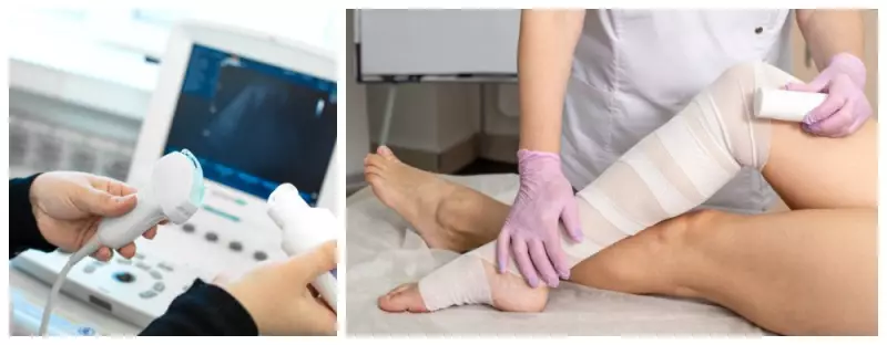 Estudo brasileiro cria critérios para diagnóstico por imagem do lipedema