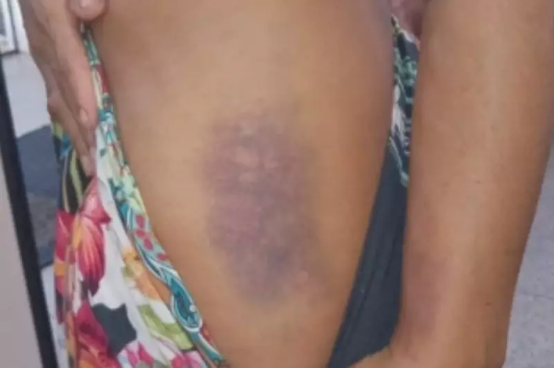 Ex-companheiro espanca mulher com pauladas em Caraíva; caso é investigado como tentativa de feminicídio