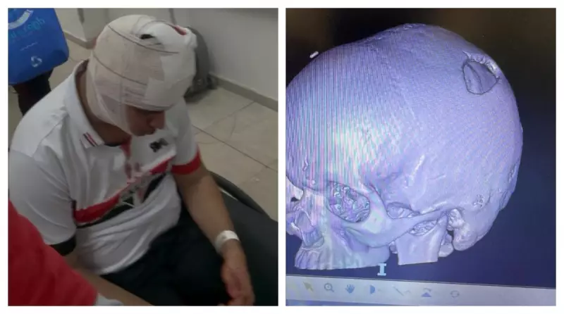 Justiça obriga São Paulo e Conmebol a pagar pensão a torcedores feridos no Morumbi