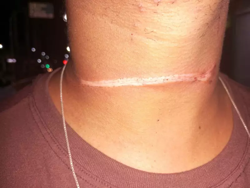 Motociclista tem pescoço atingido por fio em avenida de Unaí; PM suspeita de ação proposital