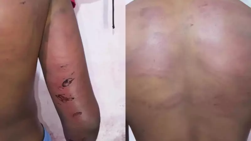 Policial é afastado no MA após denúncia de tortura contra adolescente de 17 anos