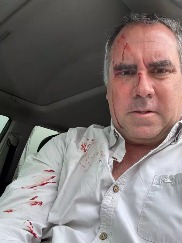 Pré-candidato à Presidência do Peru sofre ataque a tiros em caminhonete