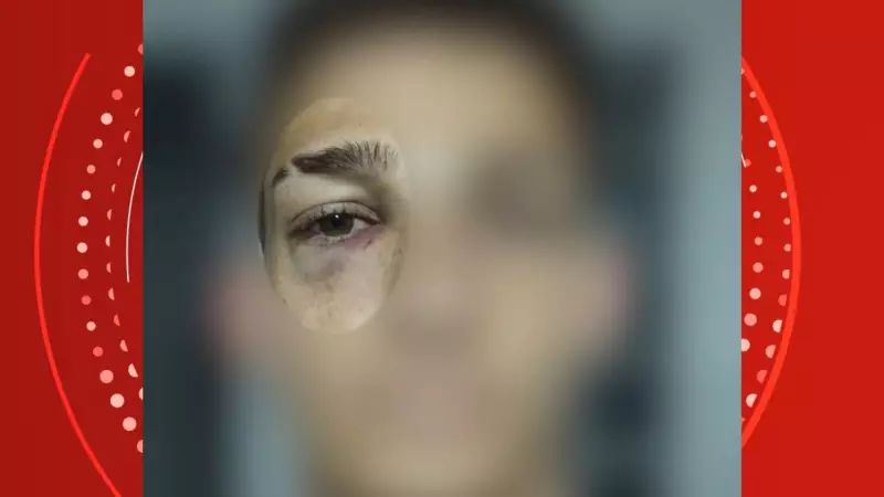 Supervisor agride jovem durante rescisão em multinacional no ES