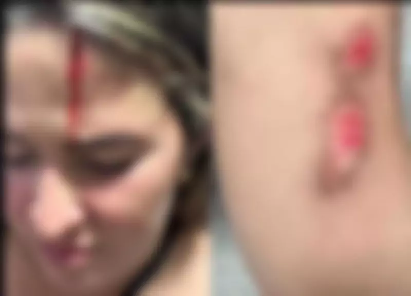 Tentativa de feminicídio em Olivença: ex atropela e agride mulher de 29 anos