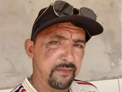Gari agredido com tijolo no AC: 47 dias após cirurgia, rosto ainda dormente e dieta líquida