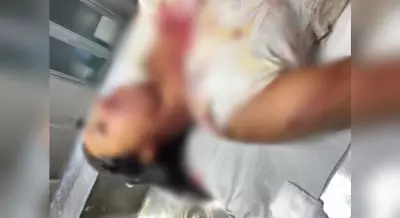 Mulher de 29 anos é agredida com barra de ferro pelo ex-namorado em Pontalinda