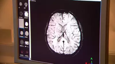 Vacina contra herpes zóster reduz risco de demência em 20%, revela estudo