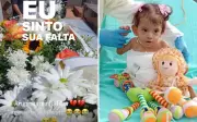 Aruna, gêmea siamesa separada em Goiânia, morre 7 meses após a irmã