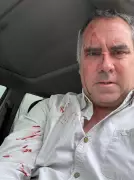 Pré-candidato à Presidência do Peru sofre ataque a tiros em caminhonete