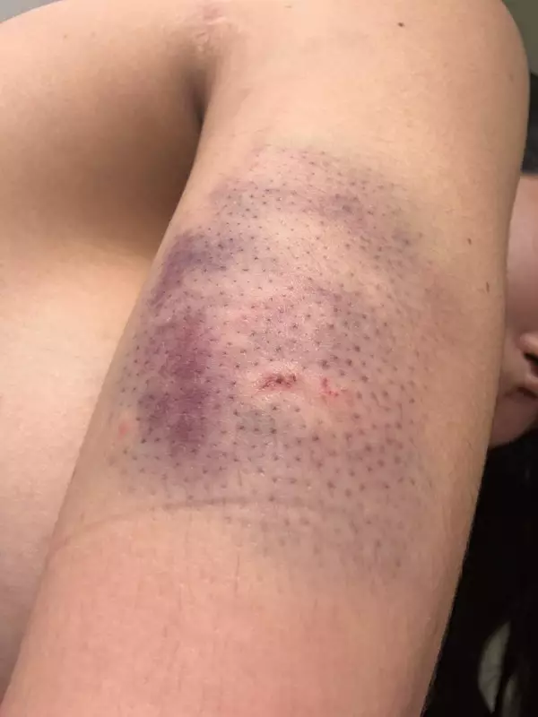 4 casos de violência de gênero em 24h em MG: tentativa de feminicídio e estupro