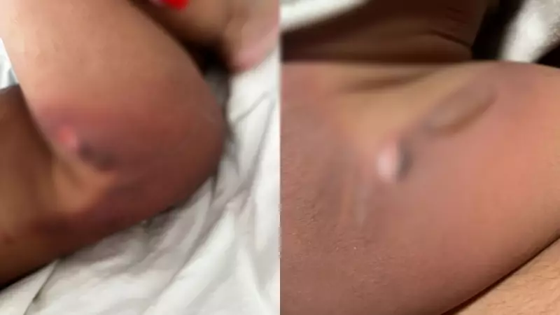 Bebê de 11 meses recebe alta após sofrer queimaduras graves durante banho em creche de Jaú