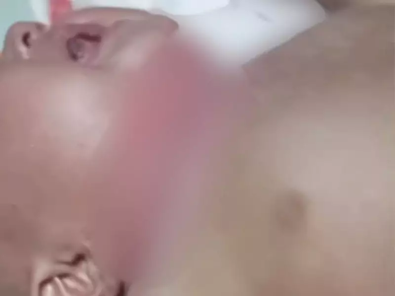 Bebê de 7 meses internada em estado grave no Acre após maus-tratos