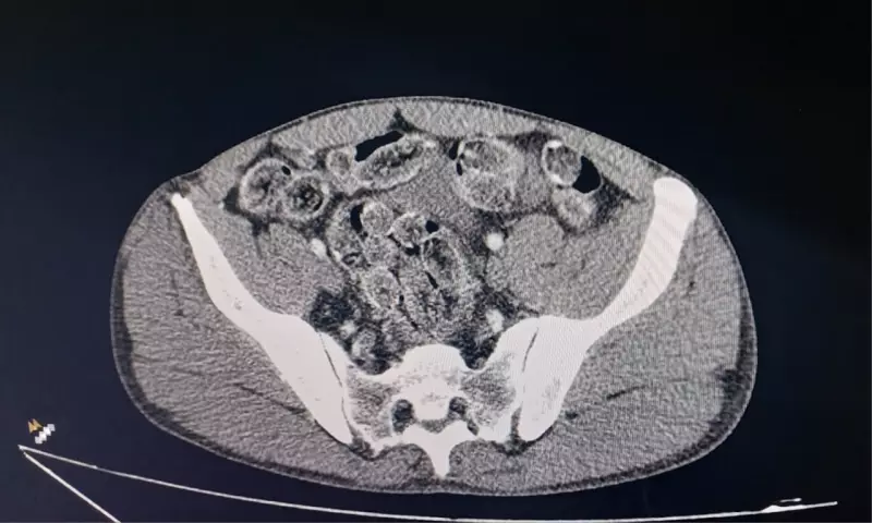 Bolivianos são presos com cocaína em cápsulas na Castello Branco; dois ingeriram droga