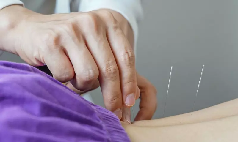 Brasil regulamenta profissão de acupunturista com nova lei assinada por Lula