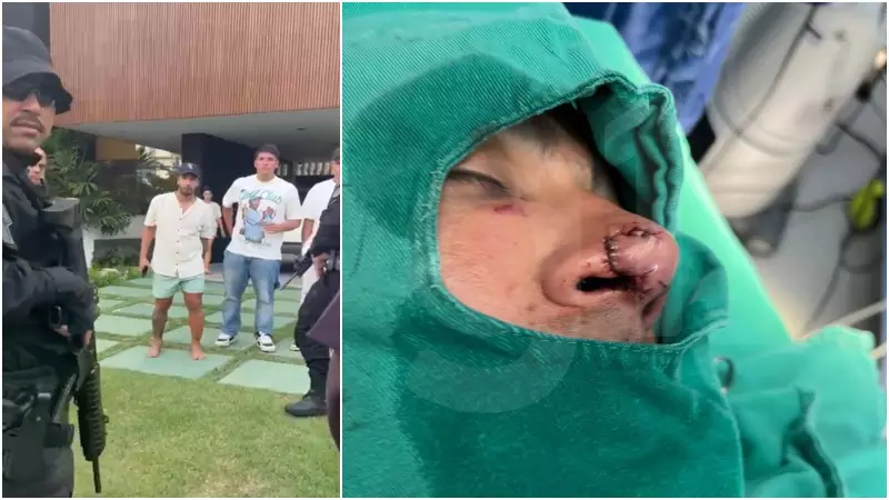 Briga no Eusébio: jogador do Fortaleza morde nariz de vizinho, que leva 7 pontos