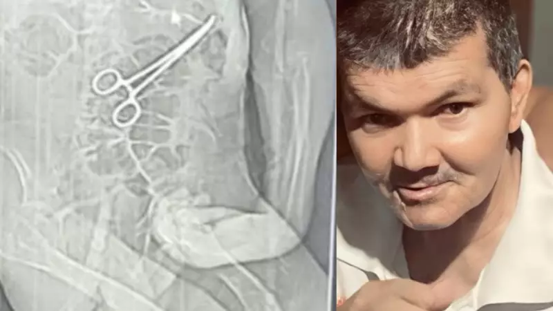 CPI instaurada em João Pinheiro após morte de idoso com pinça esquecida em cirurgia