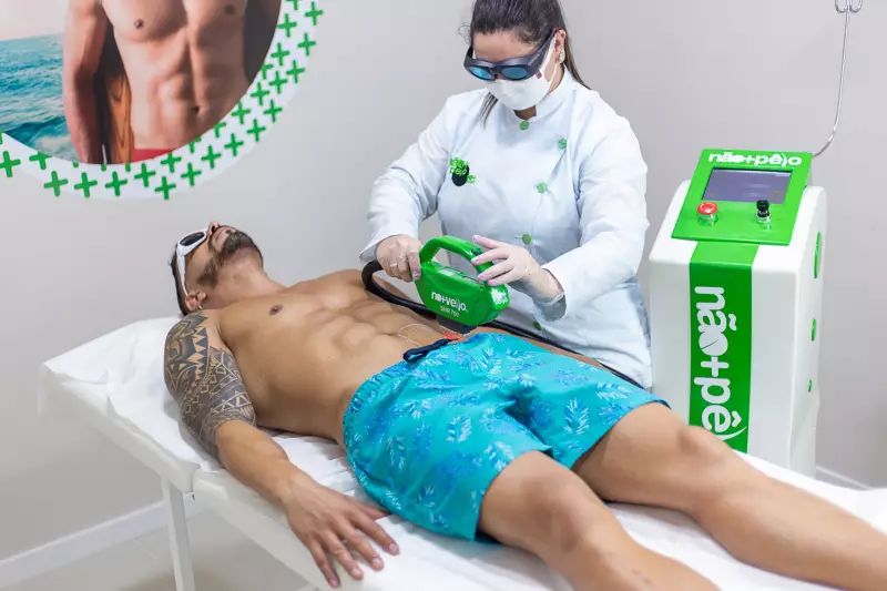Depilação a laser lidera busca masculina no mercado de estética