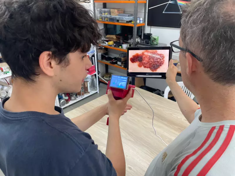 Estudantes gaúchos criam dispositivo com IA que detecta câncer de pele com 77% de precisão