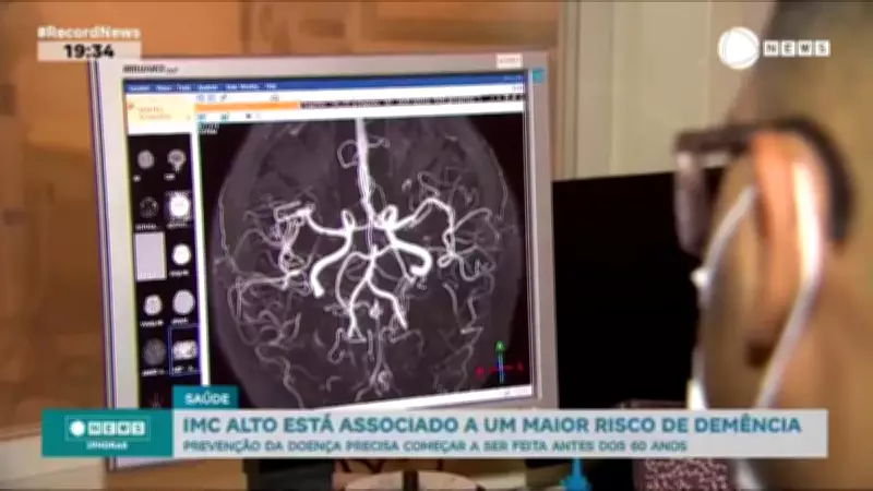 Estudo Dinamarquês Liga Obesidade a Maior Risco de Demência; Prevenção Deve Começar Cedo