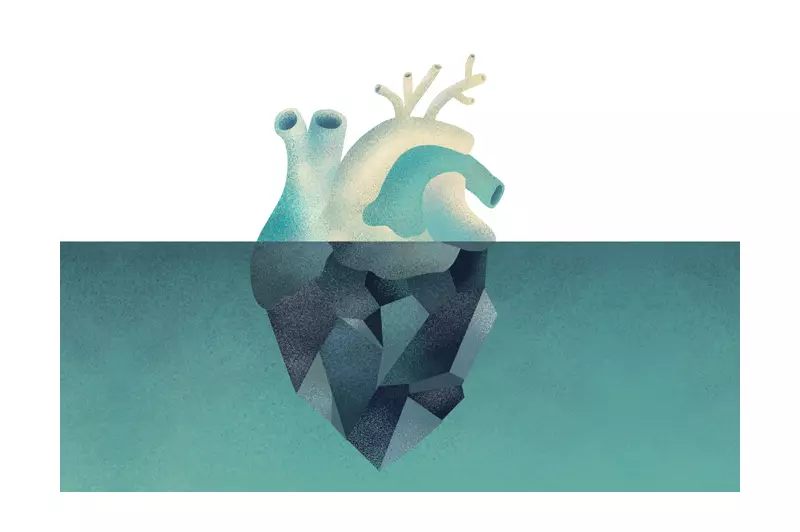 Fibrilação atrial: arritmia silenciosa cresce 137% e eleva risco de AVC