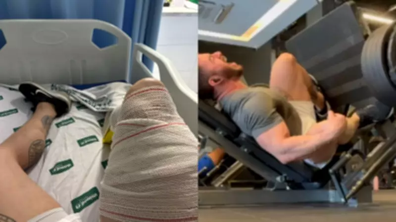 Fisiculturista rompe tendão ao levantar 400 kg em academia de Teresina e relata dor pós-cirúrgica intensa