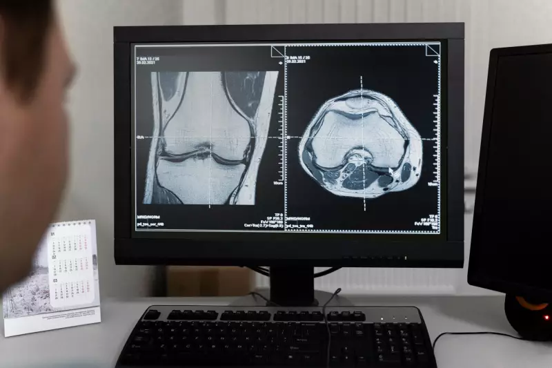 Genética explica gravidade da osteoartrite de joelho em mulheres, revela estudo brasileiro