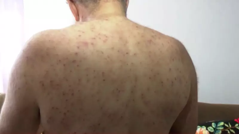 Idoso sobrevive a mil picadas de abelhas em Ponta Grossa e relata: 'Foi um milagre'