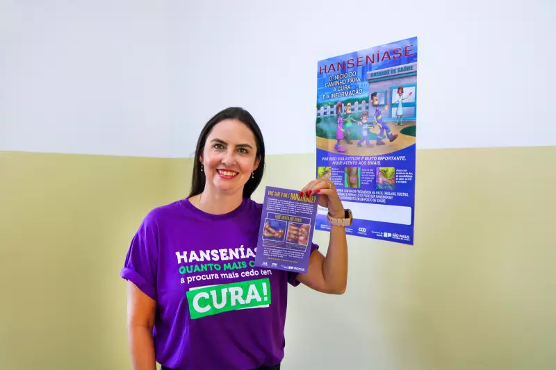 Janeiro Roxo: Piracicaba alerta para 95% de diagnósticos tardios de hanseníase
