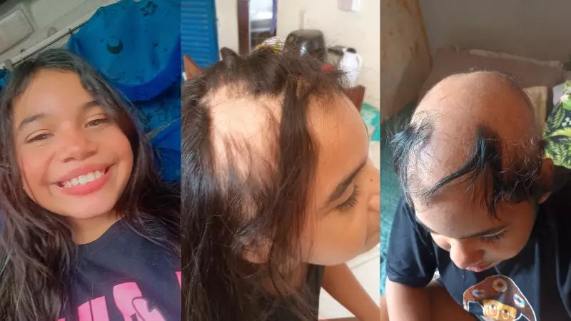 Menina de 11 anos perde 90% do cabelo por alopecia em Teresina