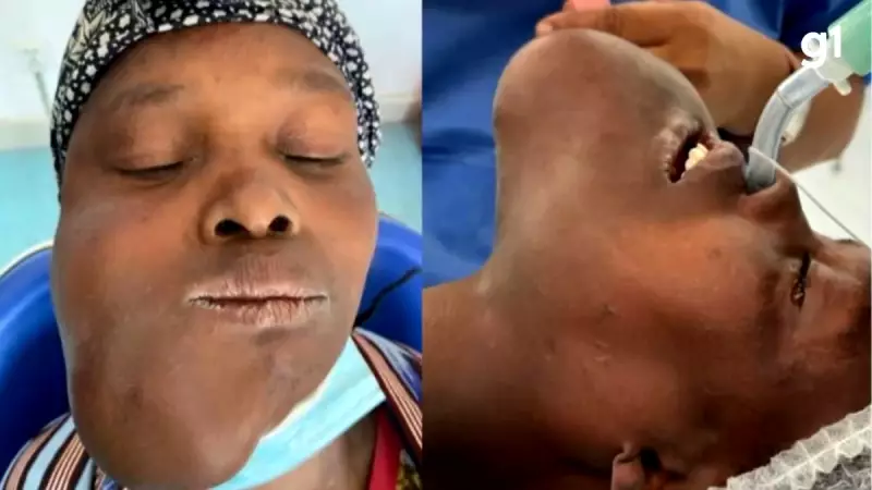 Mulher espera 1 ano por cirurgia e vira símbolo de missão humanitária de médicos gaúchos