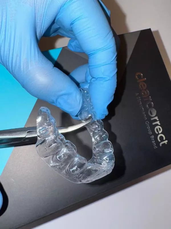 Ortodontia digital no Brasil: tecnologia exige conhecimento biomecânico para evitar falhas