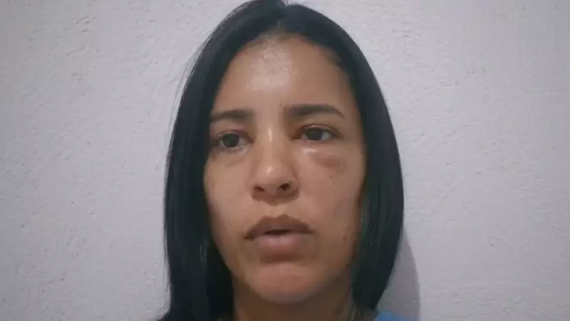 Secretária de Saúde relata agressão por ex: 'Ele criou fantasia de que era orgulho'