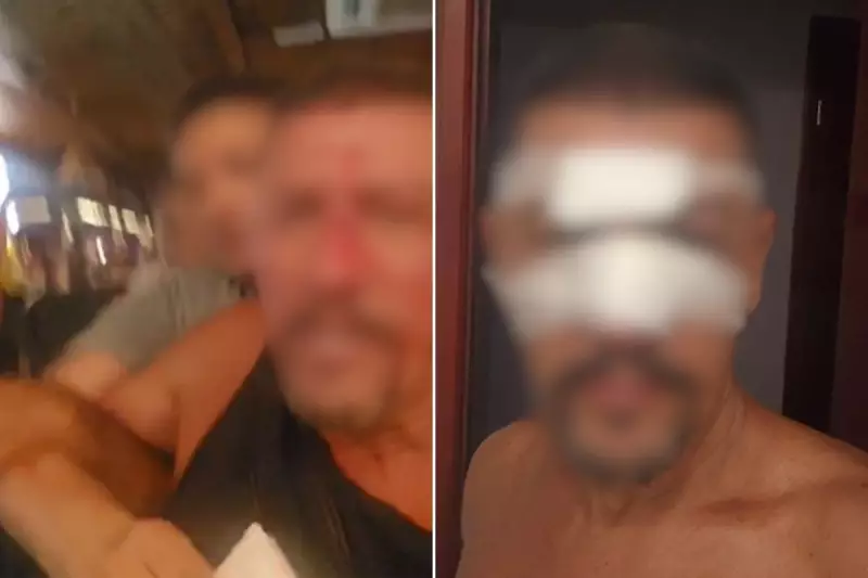 Segurança agride cliente com soco no olho após confusão com comanda em quiosque de Praia Grande