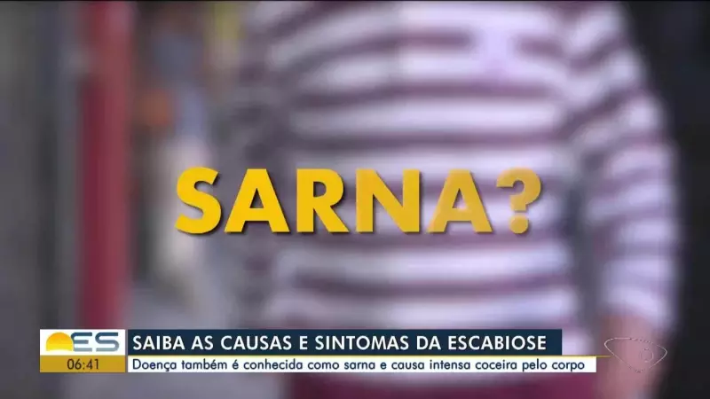São Gonçalo do Pará alerta para aumento de casos de escabiose (sarna)