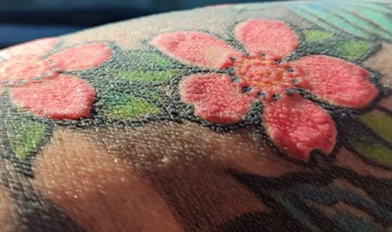 Tatuagem com tinta vermelha causa reação rara e homem perde cabelo e desenvolve vitiligo