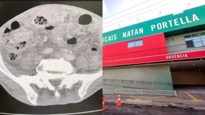 Telerradiologia gera laudos errados no Piauí e MP investiga substituição de médicos