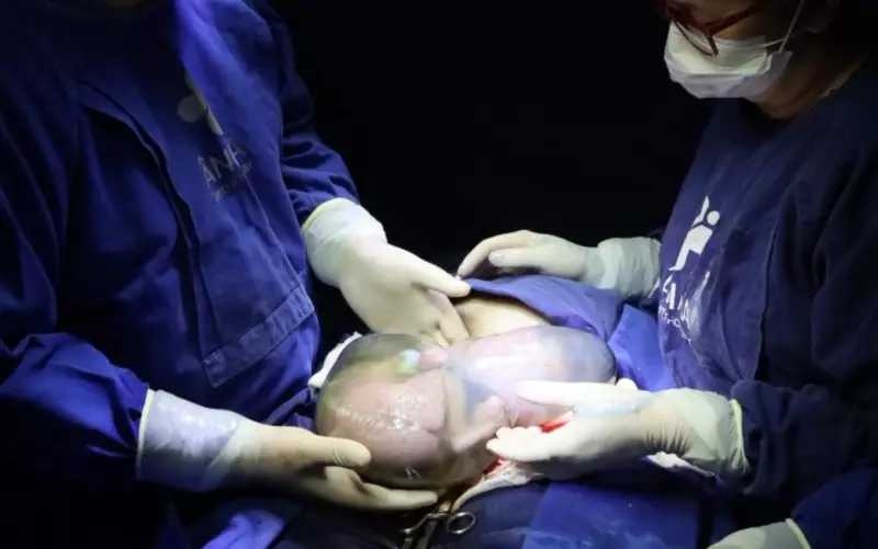 Trigêmeos nascem empelicados em Anápolis: parto raro emociona equipe