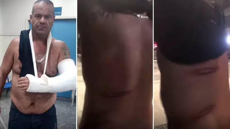 Vendedor com artrose denuncia agressão por agente municipal durante limpeza noturna no Arpoador