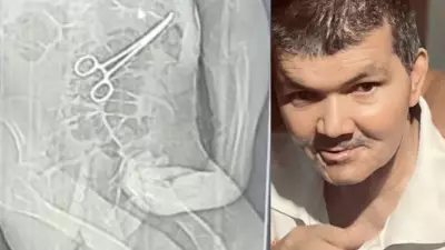 Idoso morre após cirurgia com pinça esquecida em João Pinheiro; CPI é instaurada