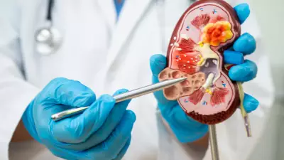 Verão eleva em 30% casos de pedra nos rins; saiba como se prevenir