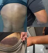 Ex-jogador Perdigão, campeão mundial pelo Inter, é agredido por PMs em Curitiba