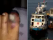 Justiça condena empresas a indenizar jovem por dedo esmagado em balsa entre Santos e Guarujá