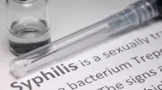 Origem da sífilis pode ter 5.500 anos e vir de caçadores-coletores da América do Sul