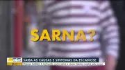 São Gonçalo do Pará alerta para aumento de casos de escabiose (sarna)