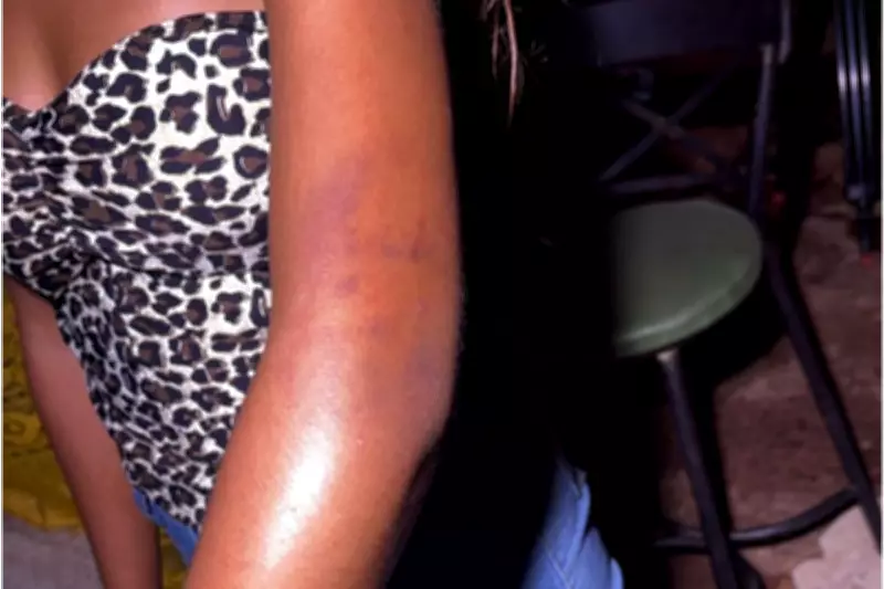 Adolescente relata agressão policial durante Carnaval em Campo Grande e diz sentir dores