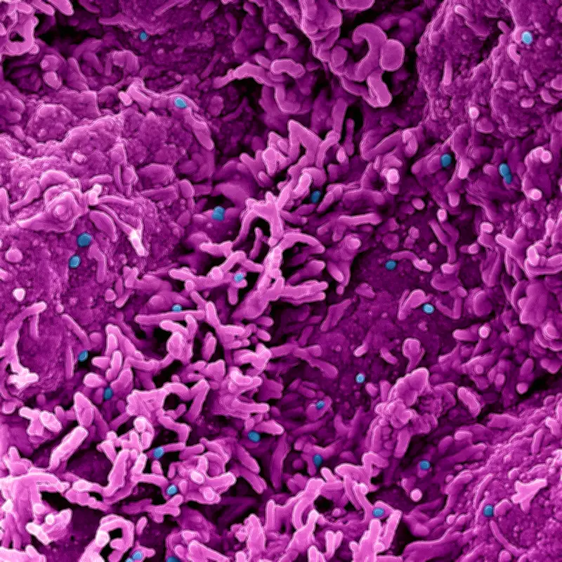 Araraquara registra primeiro caso de mpox em 2025; paciente está bem e em quarentena