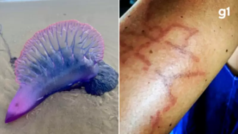 Caravelas-portuguesas causam mais de 500 queimaduras em praia do RS durante feriado