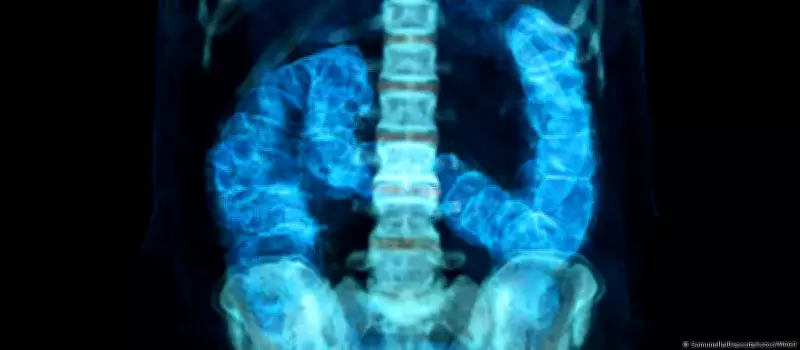 Câncer colorretal avança entre jovens: mortes devem crescer 36% no Brasil até 2040