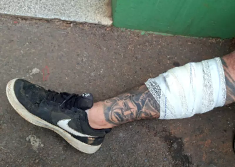 Coletor de Tupã sofre corte grave por vidro mal descartado; secretaria reforça alerta