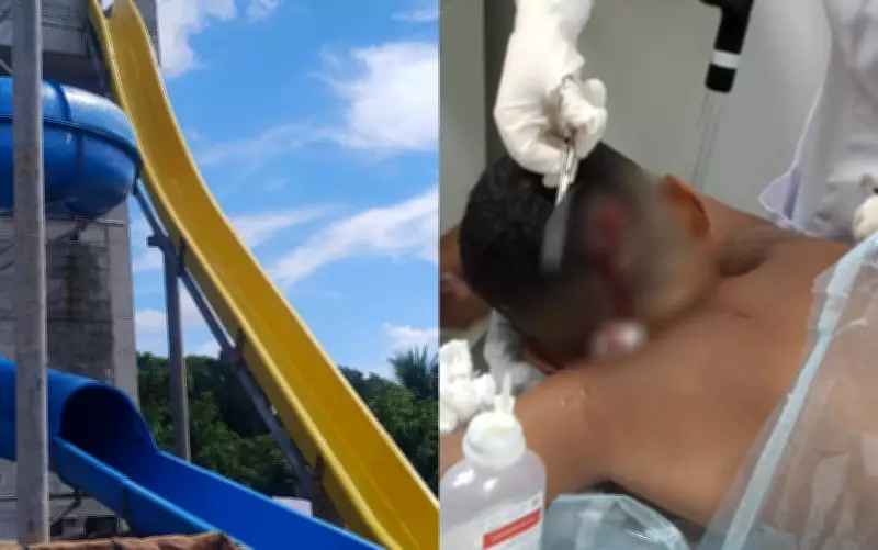 Criança se fere em tobogã e pai denuncia tentativa de suborno em parque de Abreu e Lima